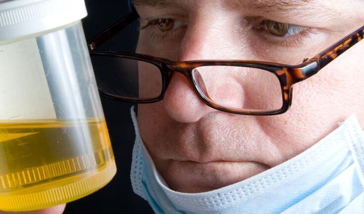 Analyse d'urine pour la prostatite chronique